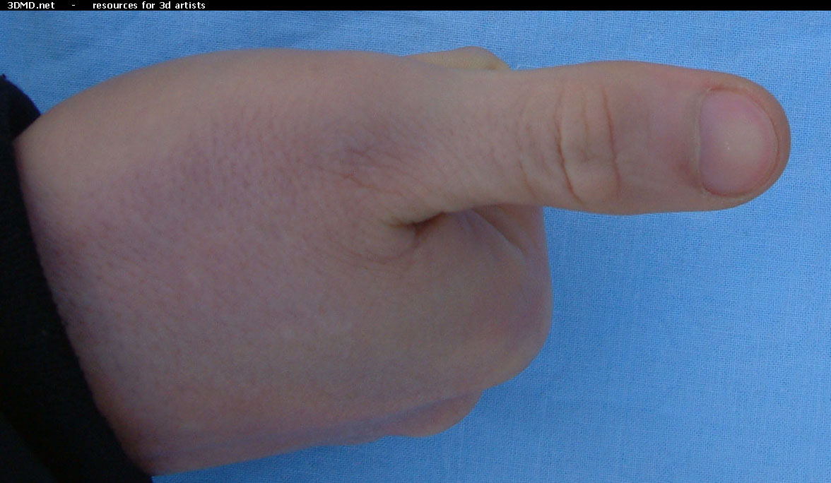 Male Thumb Photo Top  