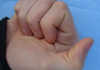 male bent thumb photo