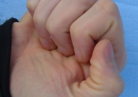 male bent thumb photo 01