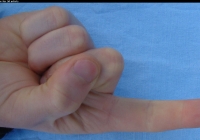 male forefinger bent bottom