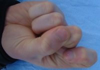 male forefinger bent bottom 03