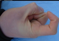 male forefinger bent left 01