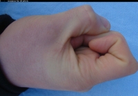 male forefinger bent left 02