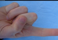 male forefinger bottom