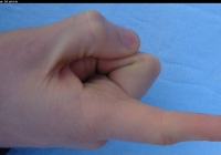 Male Palm Photo of  Left Forefinger