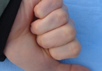 male thumb photo bottom