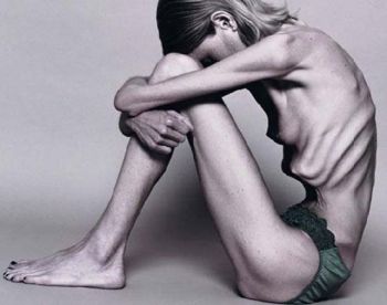 anorexia-31.jpg