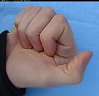 male_bent_thumb_photo.JPG