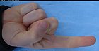 Filename=male_forefinger_bent_bottom.JPG
Filesize=200KiB
Dimensions=1508x795
Date added=Mar 03, 2009 male_forefinger_bent_bottom.JPG