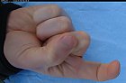 Filename=male_forefinger_bent_bottom_01.JPG
Filesize=212KiB
Dimensions=1265x836
Date added=Mar 03, 2009 male_forefinger_bent_bottom_01.JPG