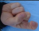 Filename=male_forefinger_bent_bottom_02.JPG
Filesize=197KiB
Dimensions=1124x879
Date added=Mar 03, 2009 male_forefinger_bent_bottom_02.JPG