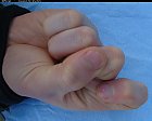 Filename=male_forefinger_bent_bottom_03.JPG
Filesize=186KiB
Dimensions=1076x865
Date added=Mar 03, 2009 male_forefinger_bent_bottom_03.JPG