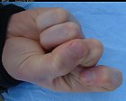 male_forefinger_bent_bottom_03.JPG