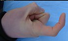 Filename=male_forefinger_bent_left.JPG
Filesize=185KiB
Dimensions=1409x854
Date added=Mar 03, 2009 male_forefinger_bent_left.JPG