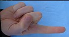 Filename=male_forefinger_bottom.JPG
Filesize=220KiB
Dimensions=1596x856
Date added=Mar 03, 2009 male_forefinger_bottom.JPG